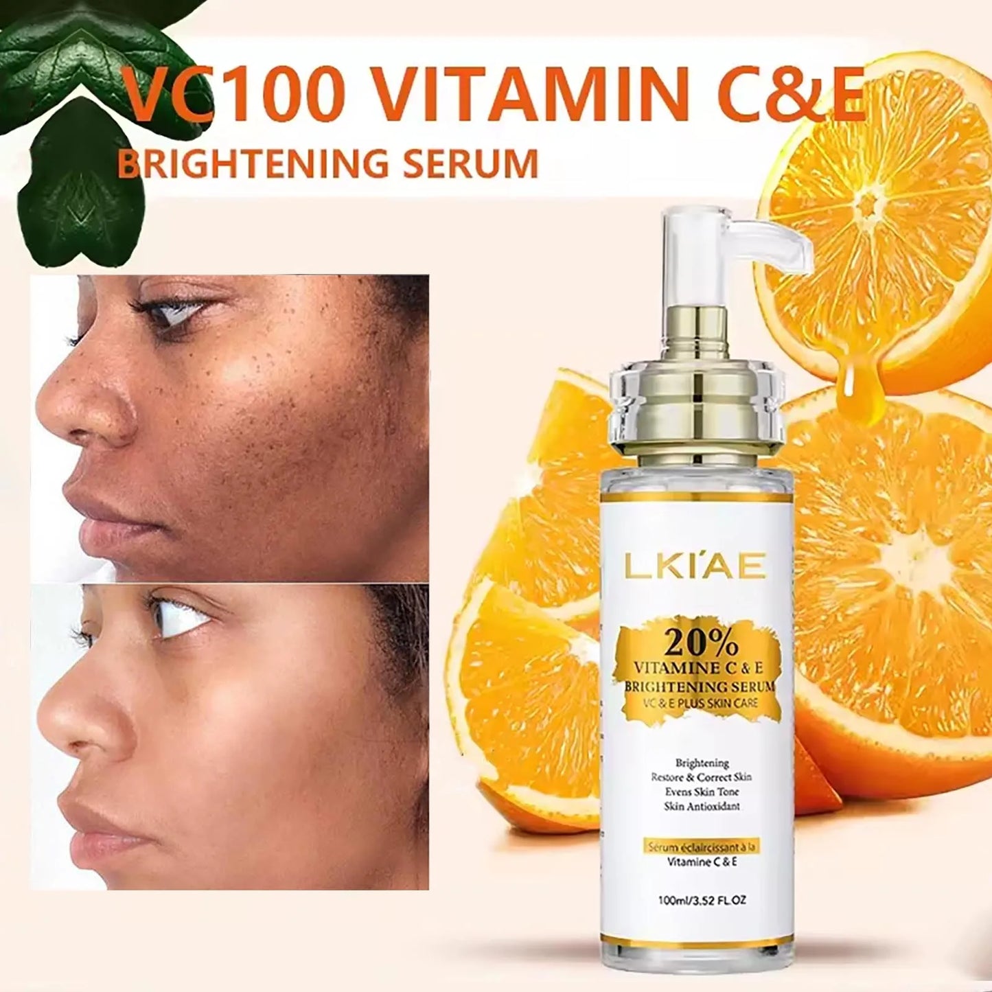 AILKE Vitamin C Skin Care Set With Brightening Soap