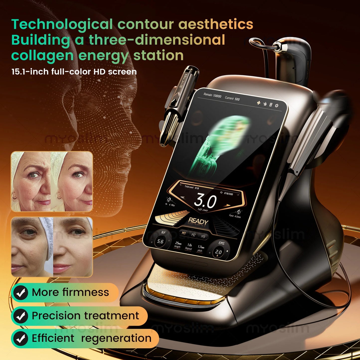 360MAX Facial Tightening And Fat Reduction Beauty Machine
